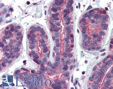 RHOA Antibody - Anti-RHOA antibody IHC of human breast. Immunohistochemistry of formalin-fixed, paraffin-embedded tissue after heat-induced antigen retrieval. Antibody concentration 5 ug/ml.