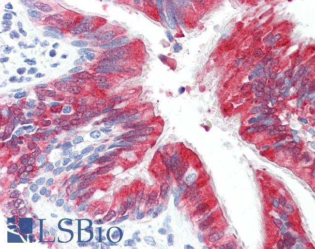 RHOBTB2 / DBC2 Antibody - Anti-RHOBTB2 / DBC2 antibody IHC staining of human lung, respiratory epithelium. Immunohistochemistry of formalin-fixed, paraffin-embedded tissue after heat-induced antigen retrieval. Antibody dilution 1:100.