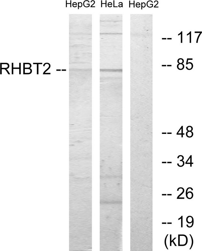 RHOBTB2 / DBC2 Antibody - Western blot analysis of lysates from HepG2 and HeLa cells, using RHBT2 Antibody. The lane on the right is blocked with the synthesized peptide.