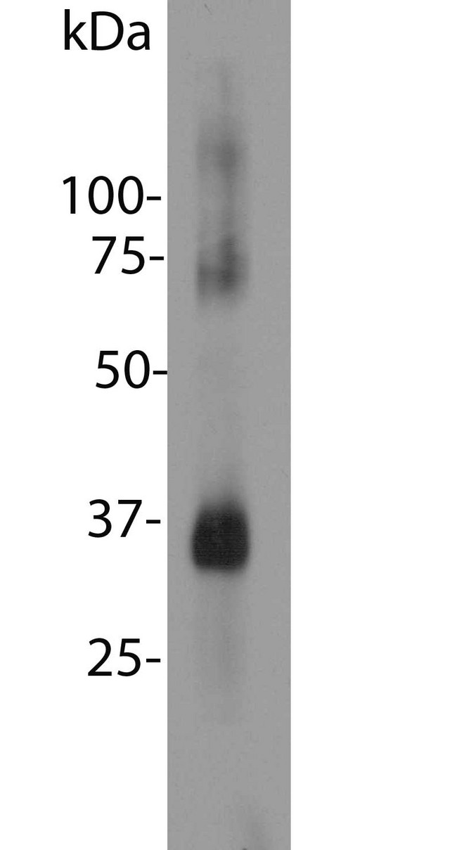 Rhodopsin / RHO Antibody - Blot of bovine retinal extracts probed with Rhodopsin / RHO antibody. The antibody stains a band corresponding to retinal rhodopsin at about 35kDa. Bands about 70 kDa and 140 kDa are aggregated forms of rhodopsin. Note, due to the highly hydrophobic nature of rhodopsin, it is important not to boil a sample containing it in SDS-PAGE sample buffer, as this will result in more extensive aggregation of the rhodopsin protein.