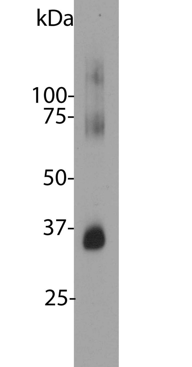 Rhodopsin / RHO Antibody - Blot of bovine retinal extracts probed with Rhodopsin / RHO antibody. The antibody stains a band corresponding to retinal rhodopsin at about 35kDa. Bands about 70 kDa and 140 kDa are aggregated forms of rhodopsin. Note, due to the highly hydrophobic nature of rhodopsin, it important to avoid boiling samples containing this protein it in SDS-PAGE sample buffer, as this will result in even more extensive aggregation of the rhodopsin protein and appearance of more of this high molecular weight material.