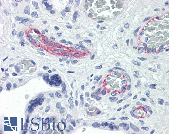 RHOE / RND3 Antibody - Anti-RND3 antibody IHC of human placenta. Immunohistochemistry of formalin-fixed, paraffin-embedded tissue after heat-induced antigen retrieval. Antibody concentration 10 ug/ml.