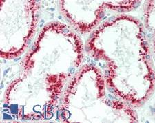 Ribonuclease A / RNASE1 Antibody - Human Kidney: Formalin-Fixed, Paraffin-Embedded (FFPE)