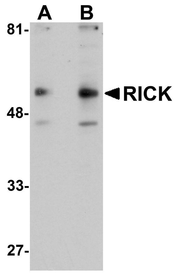 RICK / RIP2 Antibody - Western blot analysis of RICK in A431 cell lysate with RICK antibody at (A) 1 and (B) 2 ug/ml.