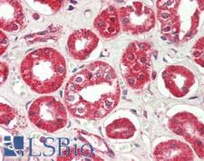RICTOR Antibody - Human Kidney: Formalin-Fixed, Paraffin-Embedded (FFPE)