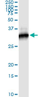 RICTOR Antibody - Immunoprecipitation of RICTOR transfected lysate using anti-RICTOR monoclonal antibody and Protein A Magnetic Bead.