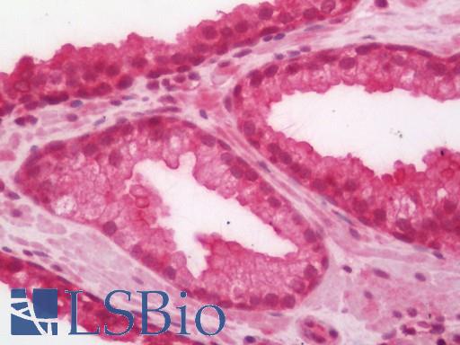 RICTOR Antibody - Human Prostate: Formalin-Fixed, Paraffin-Embedded (FFPE)
