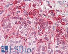 RILP Antibody - Anti-RILP antibody IHC staining of human adrenal. Immunohistochemistry of formalin-fixed, paraffin-embedded tissue after heat-induced antigen retrieval.