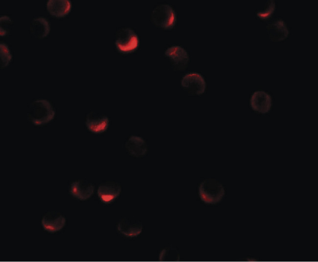 RILP Antibody - Immunofluorescence of RILP in HeLa cells with RILP antibody at 20 ug/ml.