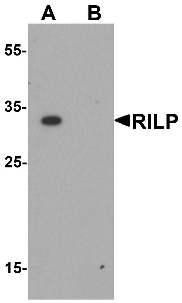 RILP Antibody - Western blot analysis of RILP in A20 cell lysate with RILP antibody at 1 ug/ml.