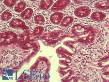 RILPL1 Antibody - Anti-RILPL1 antibody IHC staining of human small intestine. Immunohistochemistry of formalin-fixed, paraffin-embedded tissue after heat-induced antigen retrieval. Antibody concentration 5 ug/ml.