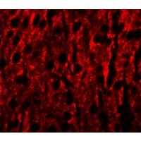 RILPL1 Antibody - Immunofluorescence of RILPL1 in mouse brain cells with RILPL1 antibody at 20 µg/mL.