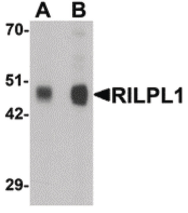 RILPL1 Antibody - Western blot of RILPL1 in rat cerebellum tissue lysate with RILPL1 antibody at (A) 0.5 and (B) 1 ug/ml.