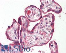 RILPL2 Antibody - Anti-RILPL2 antibody IHC staining of human placenta. Immunohistochemistry of formalin-fixed, paraffin-embedded tissue after heat-induced antigen retrieval.