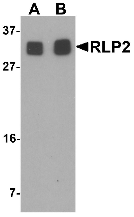RILPL2 Antibody - Western blot analysis of RLP2 in A549 cell lysate with RLP2 antibody at (A) 1 and (B) 2 ug/ml.