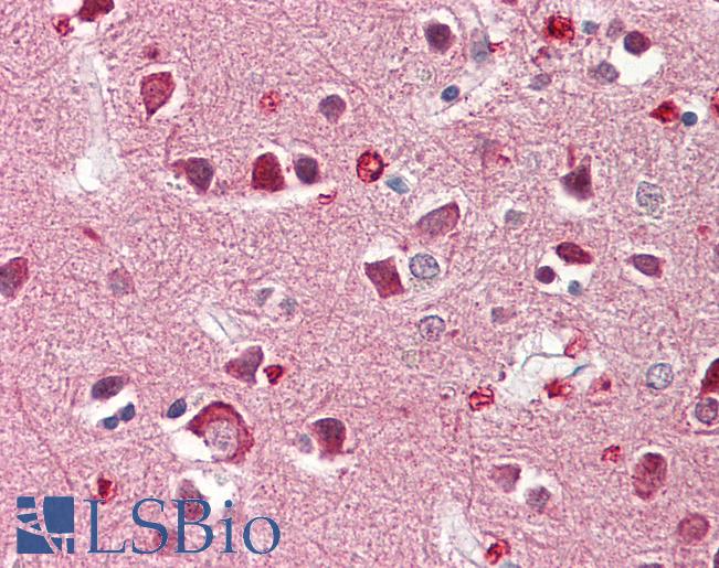 RIMS4 Antibody - Anti-RIMS4 antibody IHC of human brain, cortex. Immunohistochemistry of formalin-fixed, paraffin-embedded tissue after heat-induced antigen retrieval. Antibody dilution 5 ug/ml.