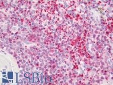 RIP1 / RALBP1 Antibody - Human Spleen: Formalin-Fixed, Paraffin-Embedded (FFPE)
