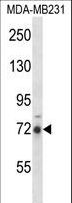 RIPK1 / RIP Antibody - RIPK1 Antibody western blot of MDA-MB231 cell line lysates (35 ug/lane). The RIPK1 antibody detected the RIPK1 protein (arrow).