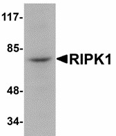RIPK1 / RIP Antibody - Western blot of RIPK1 in rat kidney tissue lysate with RIPK1 antibody at 1 ug/ml.