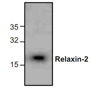 RLN2 / Relaxin 2 Antibody