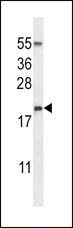 RNASE3 Antibody - RNASE3 Antibody western blot of NCI-H460 cell line lysates (35 ug/lane). The RNASE3 antibody detected the RNASE3 protein (arrow).