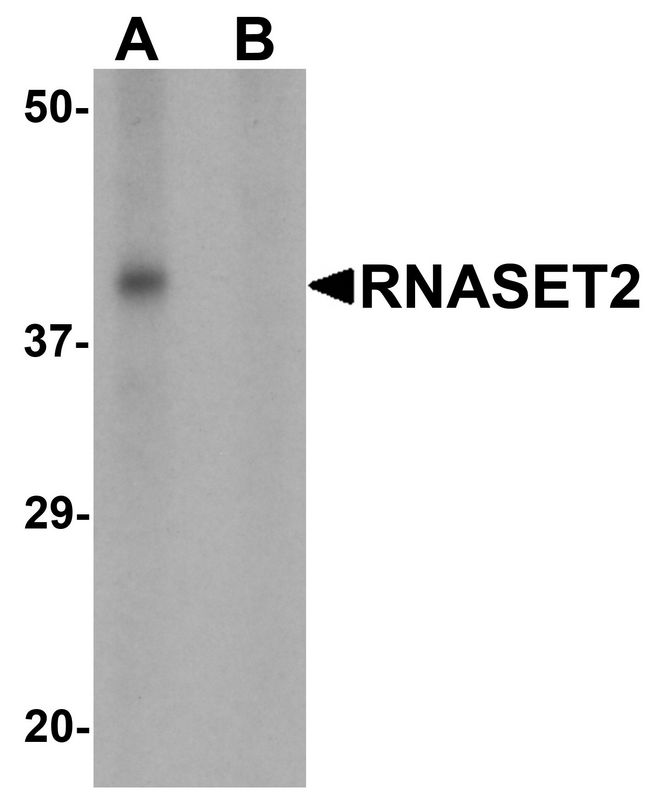 RNASET2 Antibody - Western blot analysis of RNASET2 in SW480 cell lysate with RNASET2 antibody at 1 ug/ml in (A) the absence and (B) the presence of blocking peptide.
