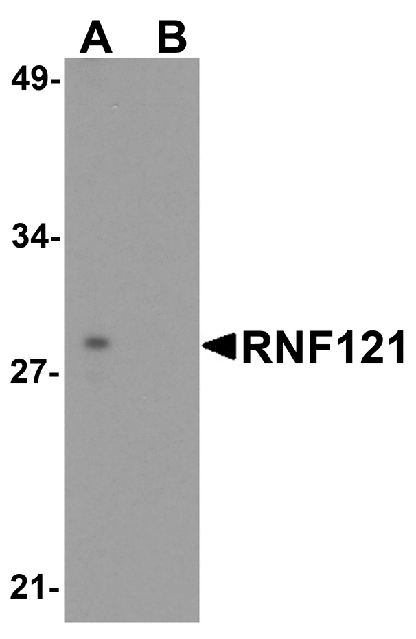 RNF121 Antibody - Western blot analysis of RNF121 in MCF7 cell lysate with RNF121 antibody at 1 ug/ml in (A) the absence and (B) the presence of blocking peptide.