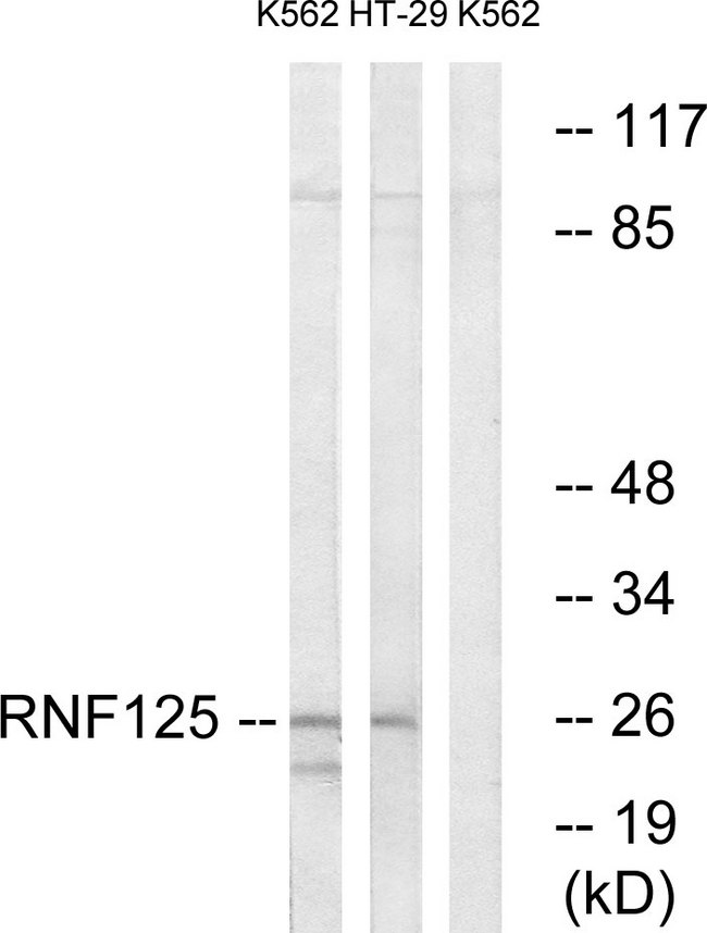 RNF125 / TRAC-1 Antibody - Western blot analysis of lysates from K562 and HT-29 cells, using RNF125 Antibody. The lane on the right is blocked with the synthesized peptide.