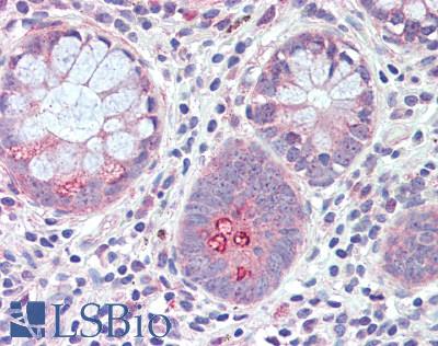 RNF128 / GRAIL Antibody - Human Small Intestine: Formalin-Fixed, Paraffin-Embedded (FFPE)