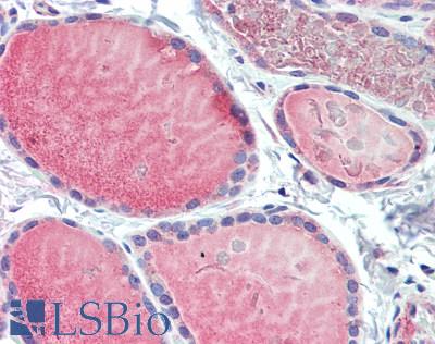 RNF128 / GRAIL Antibody - Human Thyroid: Formalin-Fixed, Paraffin-Embedded (FFPE)