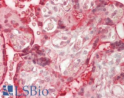 RNF138 Antibody - Human Placenta: Formalin-Fixed, Paraffin-Embedded (FFPE)