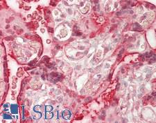 RNF138 Antibody - Human Placenta: Formalin-Fixed, Paraffin-Embedded (FFPE)