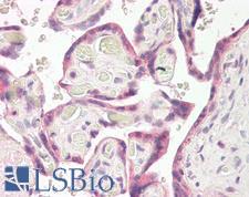 RNF139 / TRC8 Antibody - Anti-RNF139 / TRC8 antibody IHC of human placenta. Immunohistochemistry of formalin-fixed, paraffin-embedded tissue after heat-induced antigen retrieval. Antibody dilution 3.75 ug/ml.