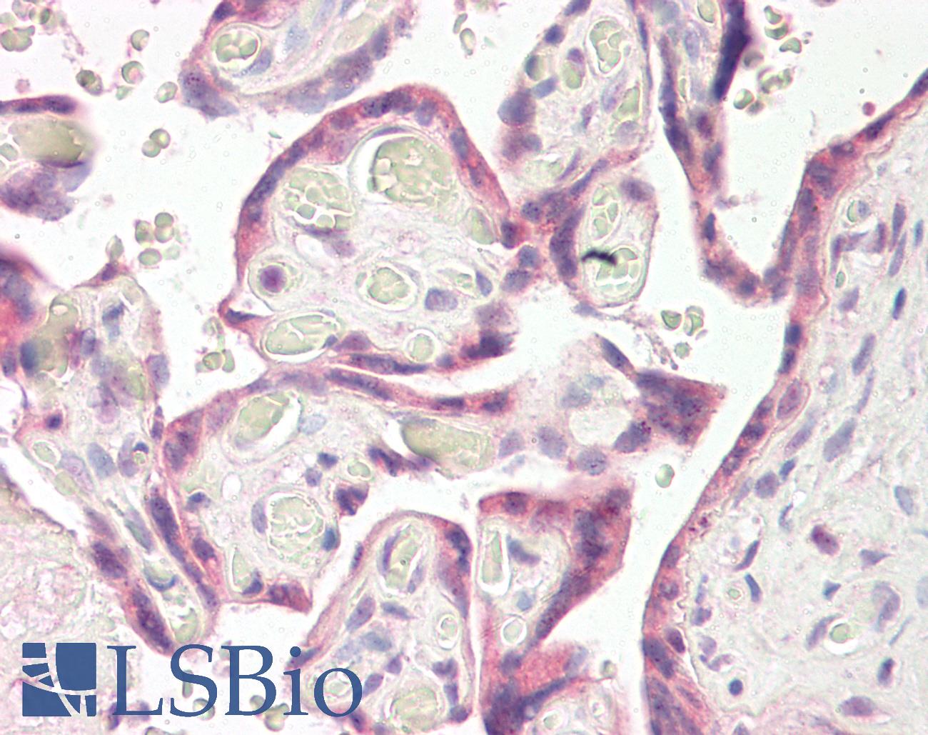 RNF139 / TRC8 Antibody - Anti-RNF139 / TRC8 antibody IHC of human placenta. Immunohistochemistry of formalin-fixed, paraffin-embedded tissue after heat-induced antigen retrieval. Antibody dilution 3.75 ug/ml.