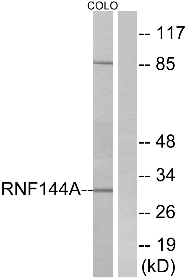 RNF144A / RNF144 Antibody - Western blot analysis of lysates from COLO cells, using RNF144A Antibody. The lane on the right is blocked with the synthesized peptide.