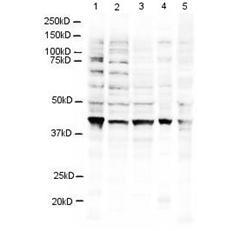 RNF2 / RING2 / RING1B Antibody - Anti-RING1B Antibody - Western Blot. Western blot of Affinity Purified anti-RING1B antibody shows detection of a 38 kD band corresponding to human RING1B in 3T3 (lane 1), U937 (lane 2), Jurkat (lane 3), mouse brain (lane 4) and CHO-K1 (lane 5) cell lysates. Approximately 20 ug of lysate was run on a SDS-PAGE and transferred onto nitrocellulose followed by reaction with a 1:500 dilution of anti-RING1B antibody incubated at room temperature. Signal was detected using standard techniques.