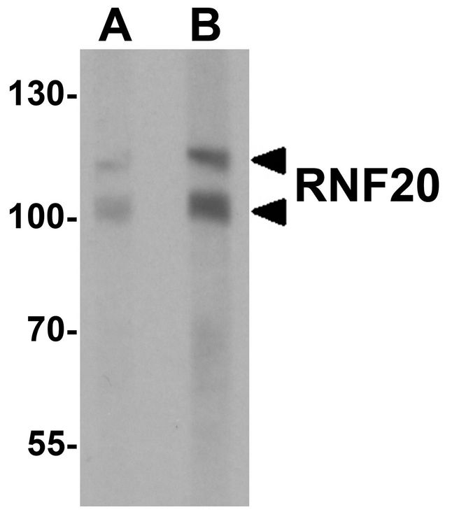 RNF20 Antibody - Western blot analysis of RNF20 in human liver tissue lysate with RNF20 antibody at (A) 1 and (B) 2 ug/ml.