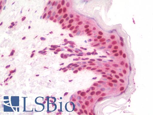 RNF20 Antibody - Anti-RNF20 antibody IHC staining of human skin. Immunohistochemistry of formalin-fixed, paraffin-embedded tissue after heat-induced antigen retrieval. Antibody concentration 10 ug/ml.