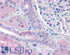 RNF213 Antibody - Anti-RNF213 antibody IHC of human kidney. Immunohistochemistry of formalin-fixed, paraffin-embedded tissue after heat-induced antigen retrieval. Antibody concentration 5 ug/ml.