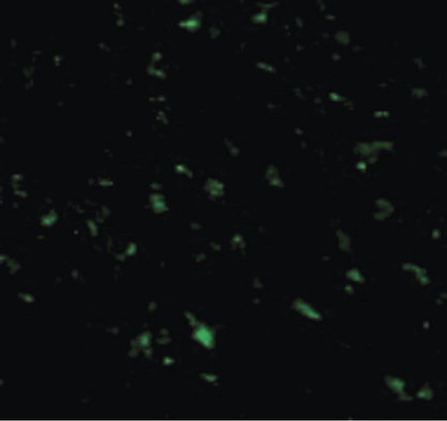 RNF216 / TRIAD3 Antibody - Immunofluorescence of TRIAD3A in Mouse Heart cells with TRIAD3A antibody at 20 ug/ml.