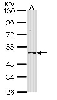 RNF25 Antibody - Sample (30 ug of whole cell lysate). A: H1299. 10% SDS PAGE. RNF25 antibody diluted at 1:1000. 
