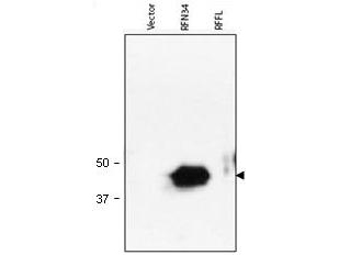 RNF34 Antibody - Anti-RNF34 Antibody - Western Blot. Western blot of Protein A Purified anti-RNF34 antibody shows detection of human RNF34 (arrowhead) in lysate. Lanes corresponding to empty vector 293T cell lysate (mock, left); RNF34 transfected lysate (middle) and RFFL transfected lysate (right), are shown using 20 ul of lysate per lane. Lysates were prepared from equivalent numbers of cells. Data presented demonstrate that this reagent is specific for RNF34. After SDS-PAGE and transfer, the membrane was probed with the primary antibody diluted to 1:1000 using 5% BLOTTO, 0.1% Tween-20 in PBS as the diluent. Incubation occurred for 1 h at room temperature. Personal Communication, Srinivasa Srinivasula, CCR-NCI, Bethesda, MD.