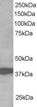 RNF39 Antibody - RNF39 / LIRF antibody staining (1µg/ml) of Human Brain lysate (RIPA buffer, 35µg total protein per lane). Primary incubated for 1 hour. Detected by chemiluminescence.