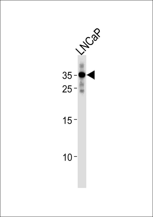 RNF4 Antibody - RNF4 Antibody western blot of LNCaP cell line lysates (35 ug/lane). The RNF4 antibody detected the RNF4 protein (arrow).