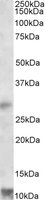 RNF7 Antibody - RNF7 antibody (1 ug/ml) staining of Human Heart lysate (35 ug protein in RIPA buffer). Primary incubation was 1 hour. Detected by chemiluminescence.