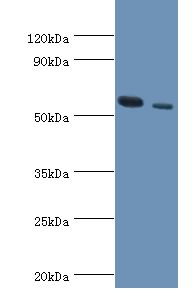 RNF8 Antibody - Western blot. All lanes: E3 ubiquitin-protein ligase RNF8 antibody at 11 ug/ml. Lane 1: HeLa whole cell lysate. Lane 2: 293T whole cell lysate. Secondary antibody: Goat polyclonal to rabbit at 1:10000 dilution. Predicted band size: 56 kDa. Observed band size: 56 kDa.