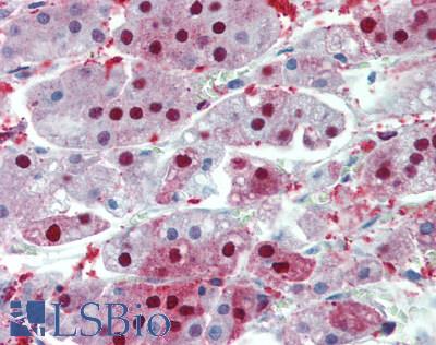 RNF8 Antibody - Human Adrenal: Formalin-Fixed, Paraffin-Embedded (FFPE), at a concentration of 10 ug/ml.