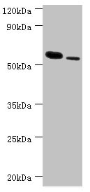 RNF8 Antibody - Western blot All lanes: RNF8 antibody at 11µg/ml Lane 1: Hela whole cell lysate Lane 2: 293T whole cell lysate Secondary Goat polyclonal to rabbit IgG at 1/10000 dilution Predicted band size: 56, 11, 51 kDa Observed band size: 56 kDa