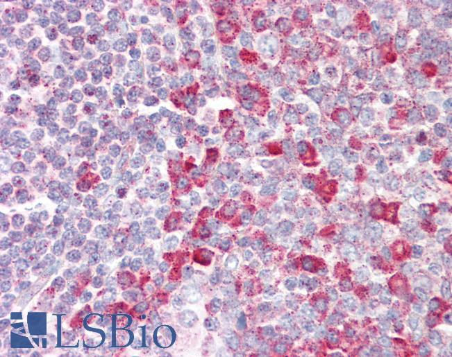 RNGTT / HCAP Antibody - Anti-RNGTT / HCAP antibody IHC staining of human tonsil. Immunohistochemistry of formalin-fixed, paraffin-embedded tissue after heat-induced antigen retrieval.