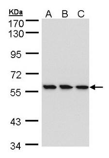 RNGTT / HCAP Antibody - Sample (30 ug of whole cell lysate). A: HeLa. B: Hep G2. C: MOLT4. 7.5% SDS PAGE. RNGTT antibody diluted at 1:1000